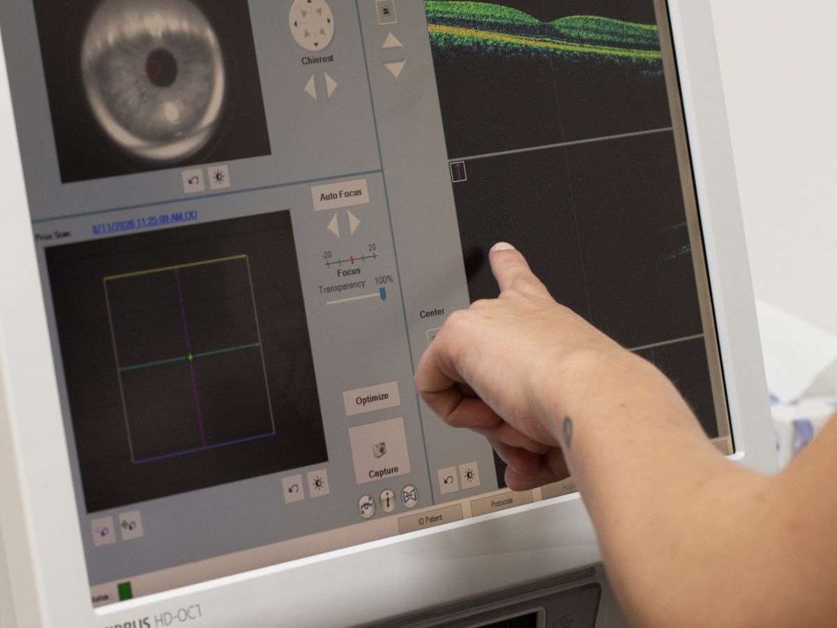 Profesional señalando una tomografía de retina en el Cirrus HD-OCT